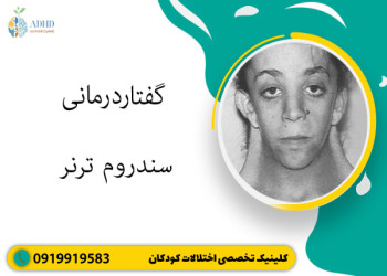 گفتاردرمانی سندروم ترنر