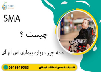 آشنایی با بیماری اس ام ای و علائم آن