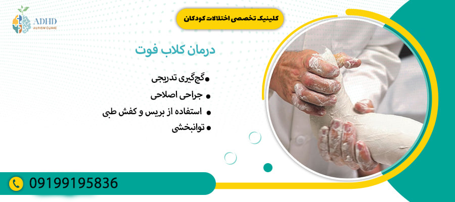 درمان کلاب فوت