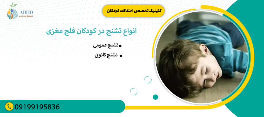 انواع تشنج در کودکان فلج مغزی