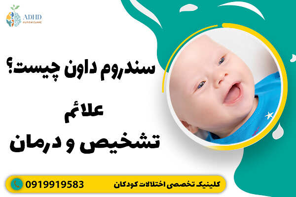 سندروم داون چیست؟ علائم، تشخیص و درمان